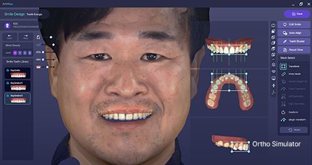 RAY - The Future of Face-Driven Dentistry