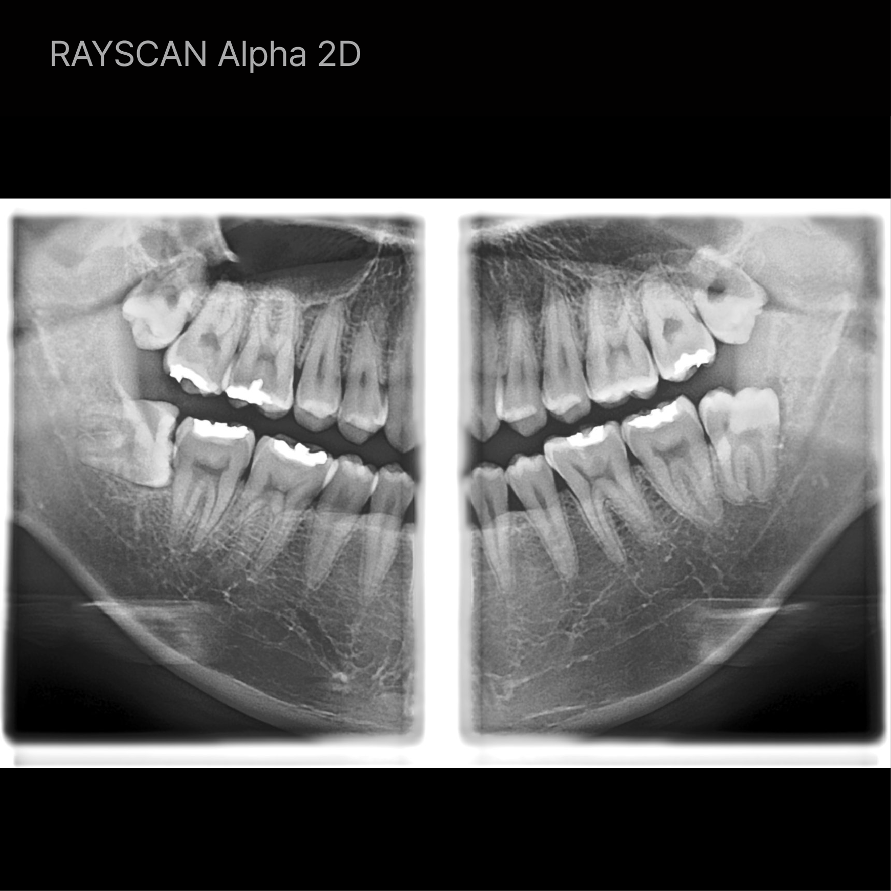 RAY - The Future of Face-Driven Dentistry