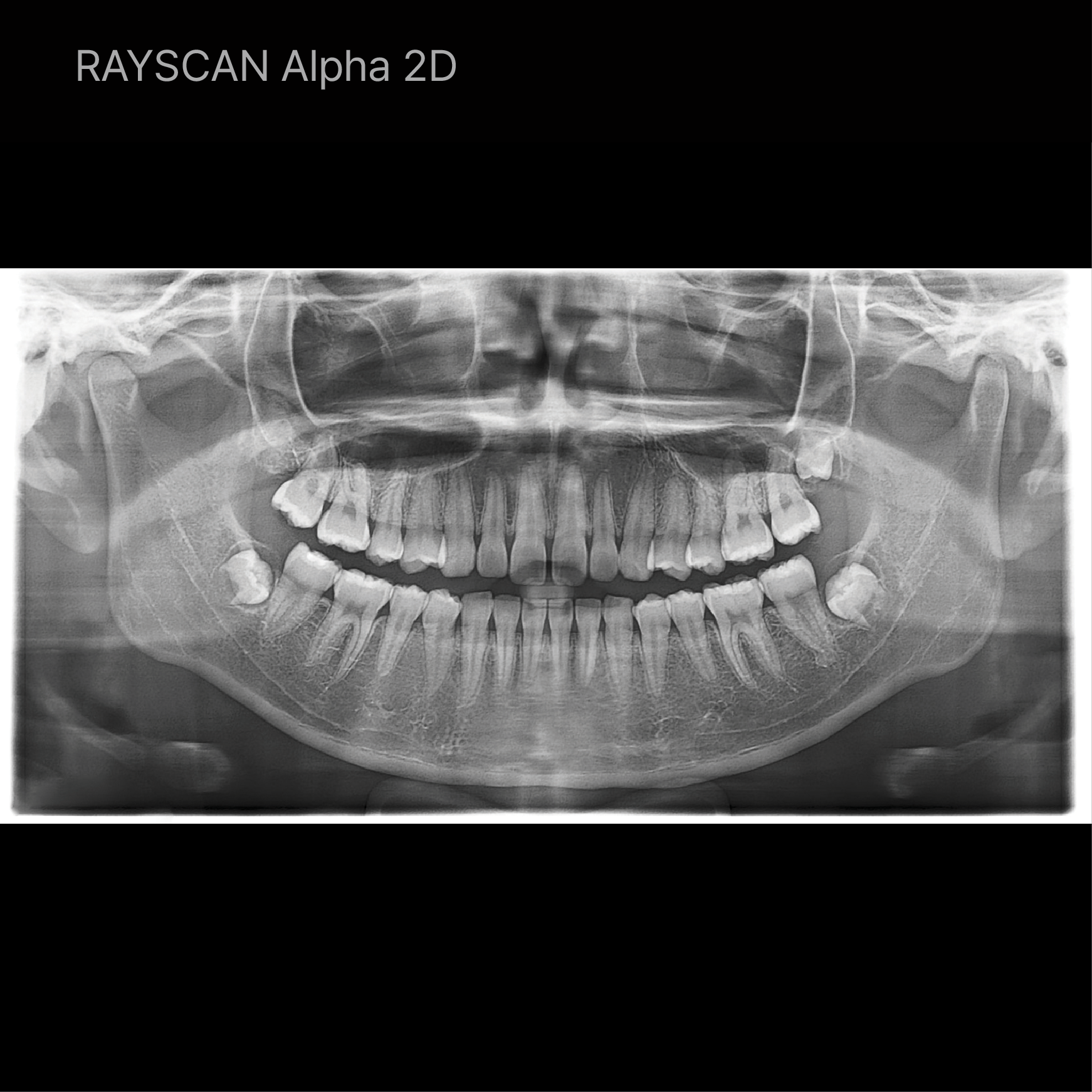 RAY - The Future of Face-Driven Dentistry