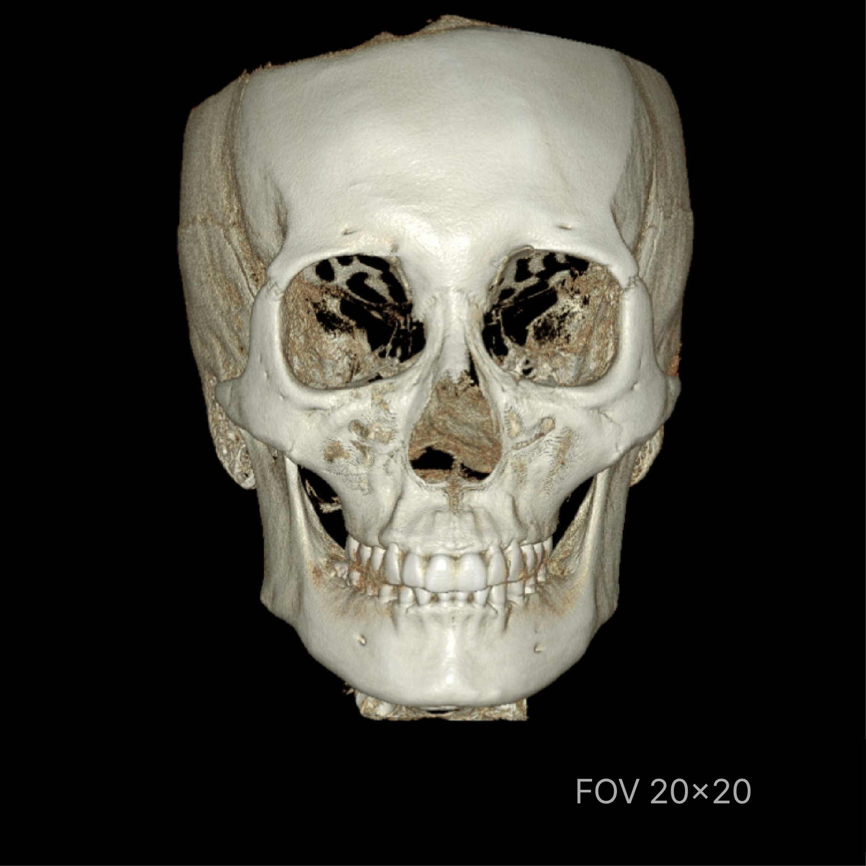 RAY - The Future of Face-Driven Dentistry